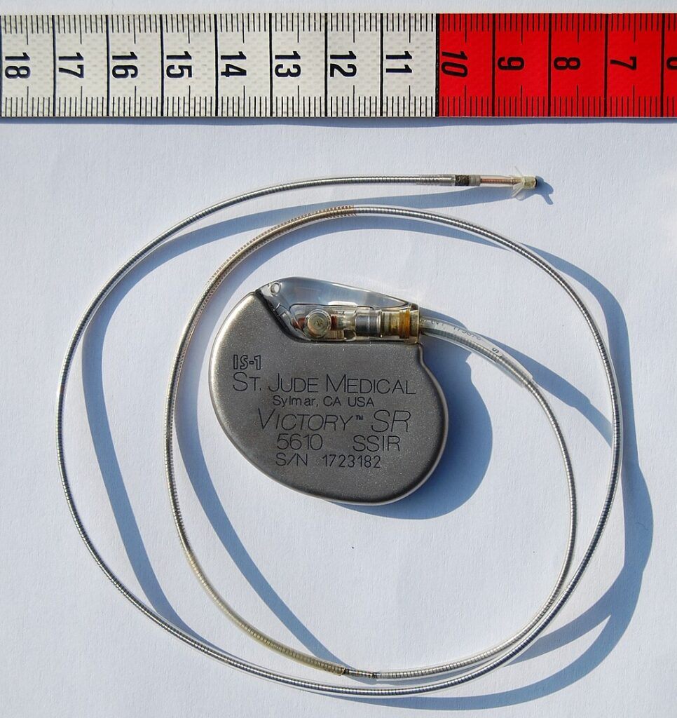 Pacemaker Came From a Circuit Mistake