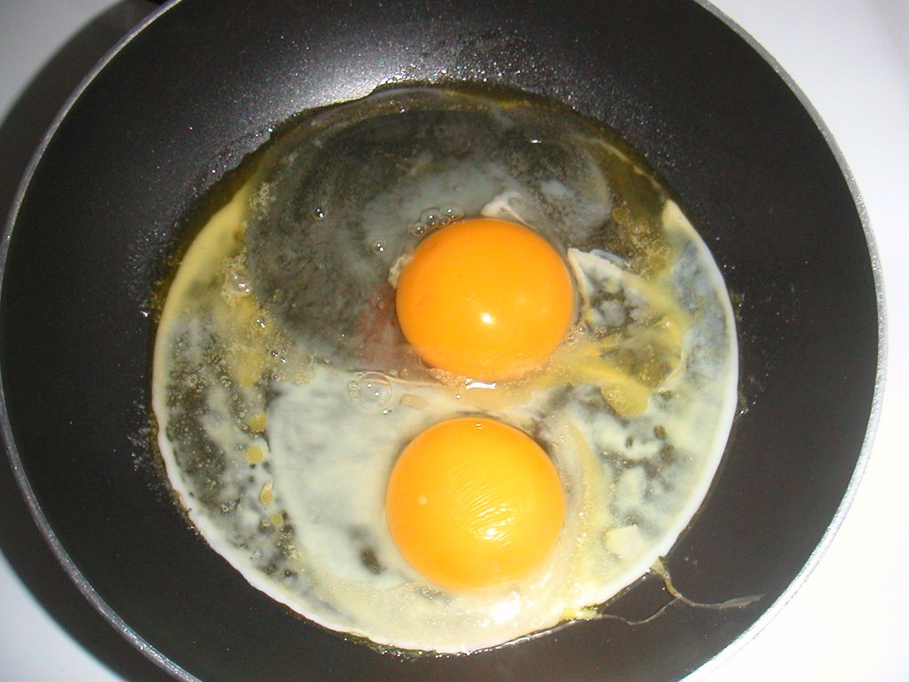 This is your brain on drugs