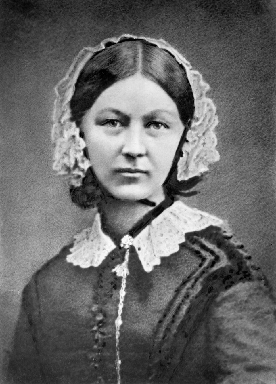 Florence Nightingale: Social Exposure And Relapse Fear